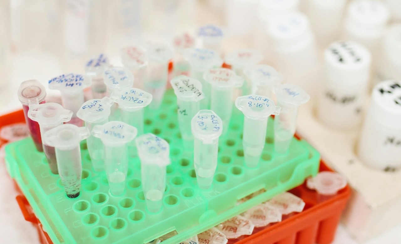 When Should Researchers Consider Histone Peptides for Epigen